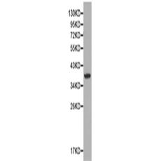 兔抗NCF4多克隆抗體