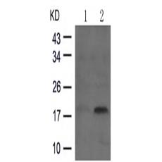 兔抗STMN1 (Phospho-Ser16)多克隆抗體