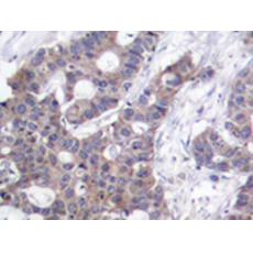 兔抗STMN1 (Phospho-Ser16)多克隆抗體